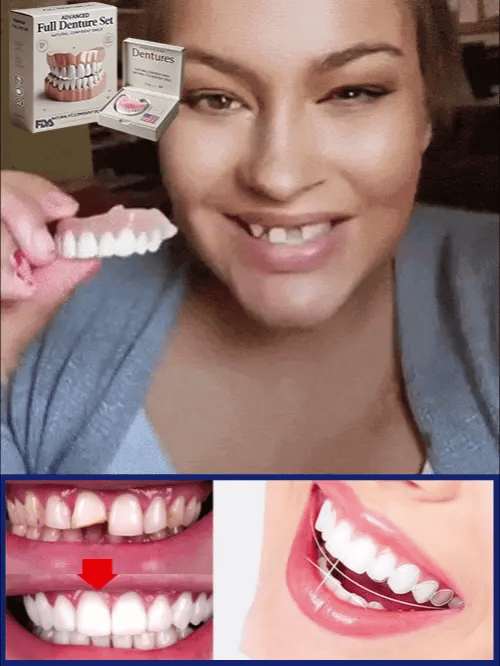 Full Denture Set